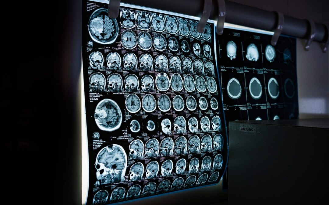 Transforming Global Healthcare: Why Distributors & Partners Choose Devenv Tech’s Medical Software